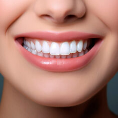lente de contato dental