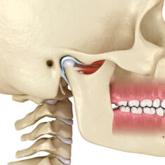 disfunção temporomandibular dtm