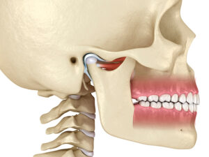 disfunção temporomandibular dtm