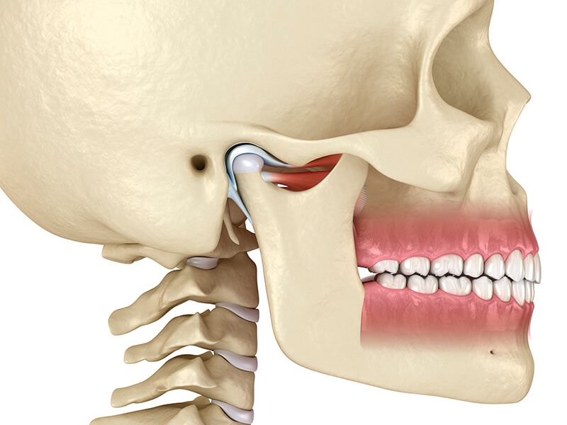 disfunção temporomandibular dtm