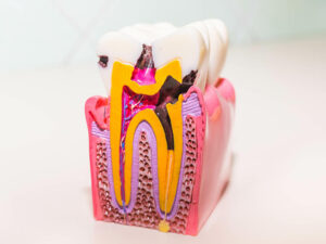 endodontia