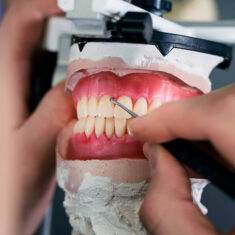próteses dentárias