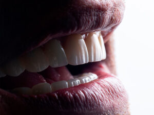 próteses dentárias