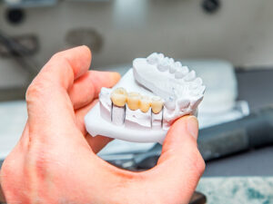 próteses dentárias